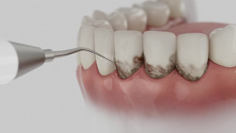 Trusted Tooth Extraction service in Russells Point, OH - Dentist Open Now